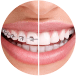 Dentaire ortodoncia